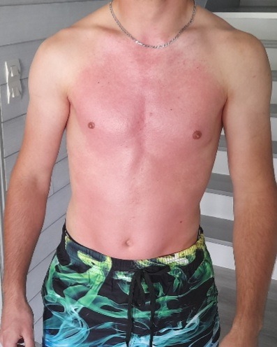 Profil de Erminio